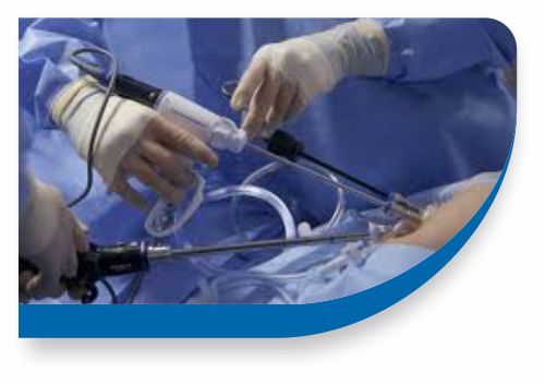 Laparoscopic Surgery