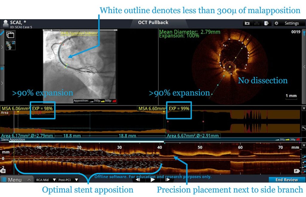 Asha Hospital - Optical Coherence Tomography (OCT)